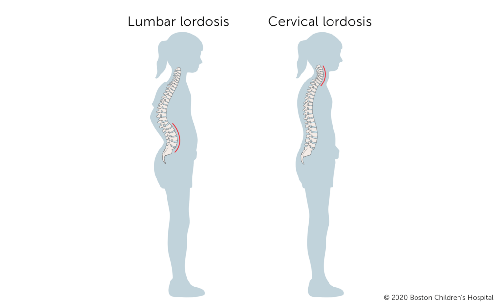 cervical and lumbar lordosis