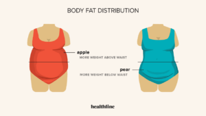 Bariatric Body Shape